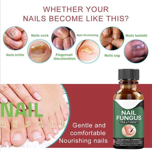 Fast Nail Fungal Treatments Nail Repair Essences Serum Care Treatments Foot Nail